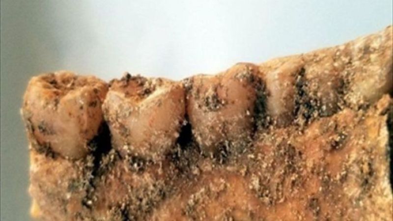 İran: 2300 yıl önce dişlerine implant yapılmış insan iskeletine rastlandı
