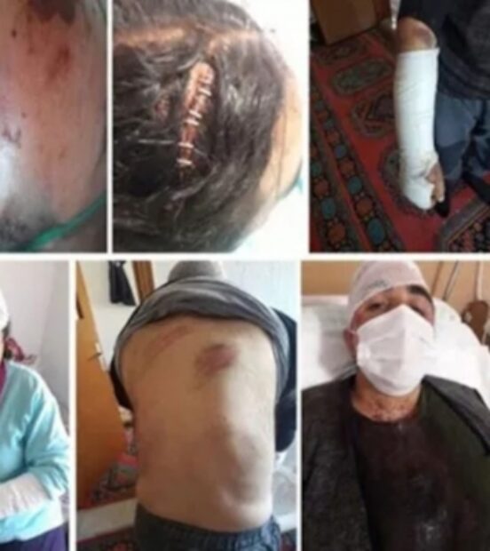Dedeoğullarına yapılan ilk saldırının sanıklarına ‘haksız tahrik’ indirimi ve tahliye!