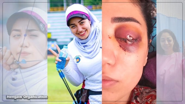 iran devleti Kirmanşanlı Kürt kadın okçu Kawsar Khoshnudinia'ı gözünden vurarak kör etti