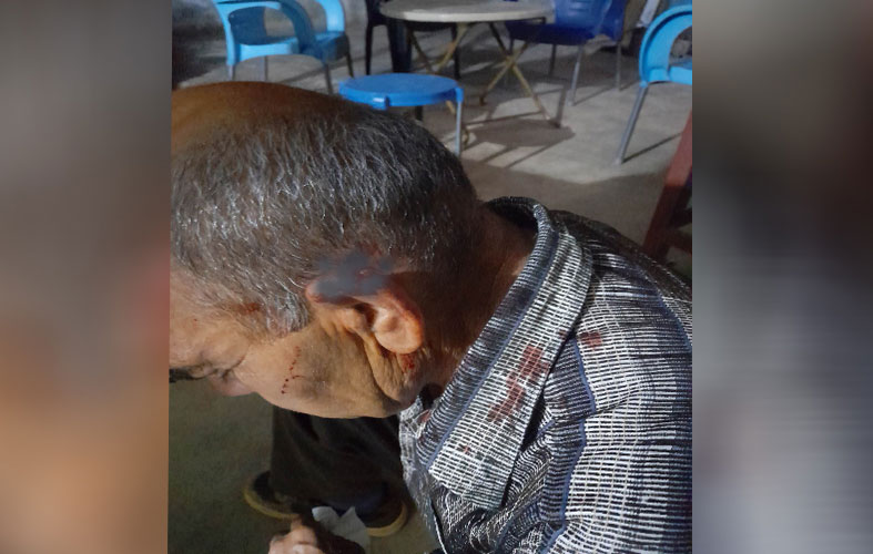 Efrin'de zulüm: Yaşlı adamı darp ettiler, öldü zannedip tarlada bıraktılar
