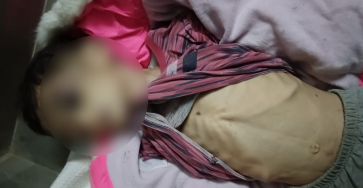 Bağdat: 5 yaşındaki çocuk işkence ile öldürüldü