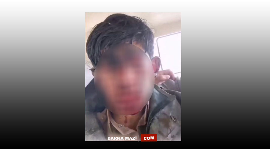 İran rejimi bir çocuk kolberi gözünden vurarak, kör etti